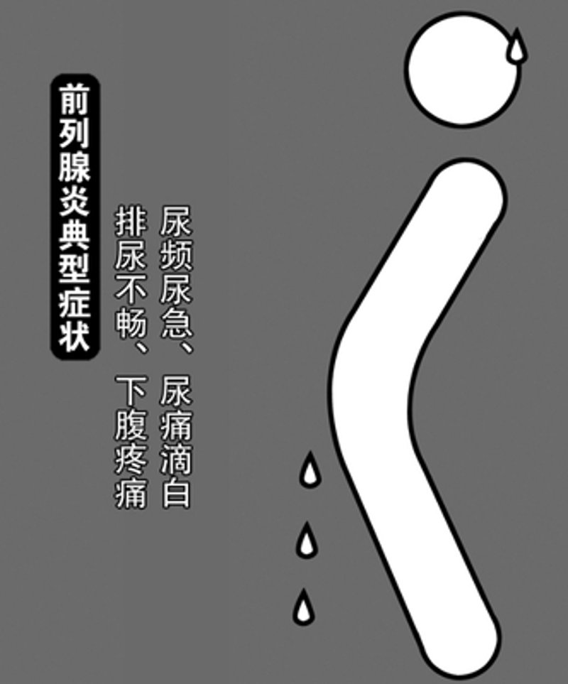 前列腺疾病的困扰：如何应对与解决