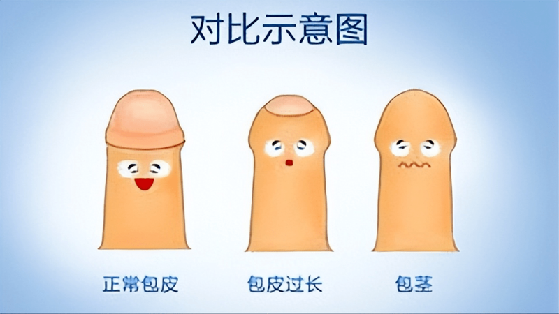 男性疾病的困扰，如何有效解决？