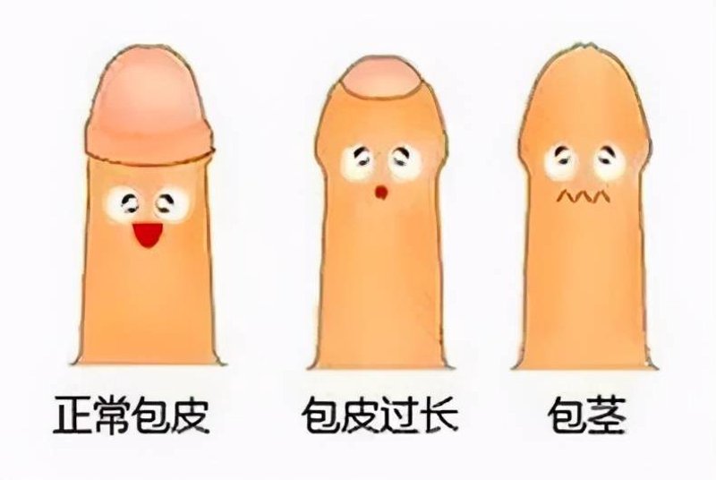 男性疾病的诊疗其实并不复杂，但往往因为讳疾忌医而延误了最佳治疗时机。今天，我们将通过问答的形式为大家详细讲解如何正确面对和处理常见的男性健康问题。