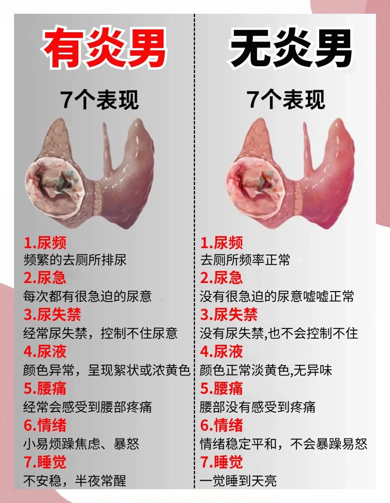 前列腺疾病
