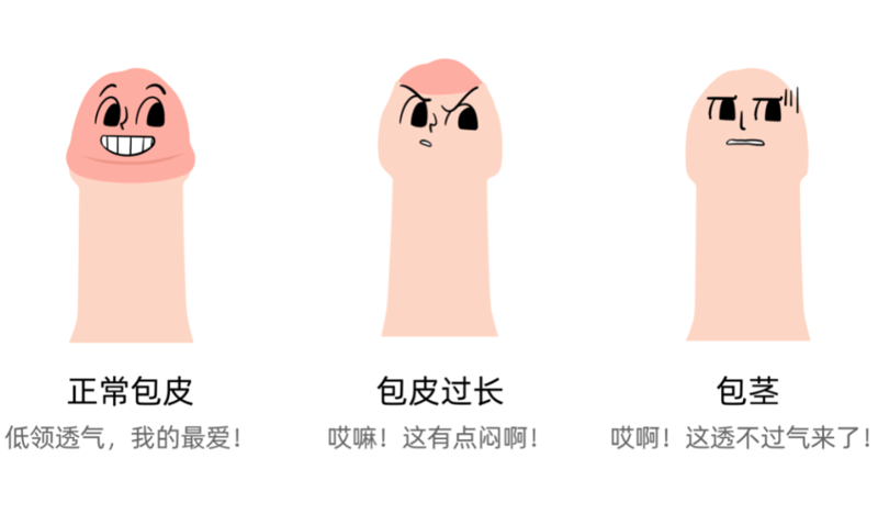 在选择包皮手术医院时，你是否感到困惑？如何才能选到一家做包皮手术做得好的医院呢？今天我们就来聊聊这个问题。